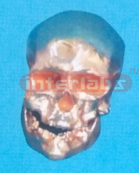 COPPERIZED CROMAGNON MAN SKULL